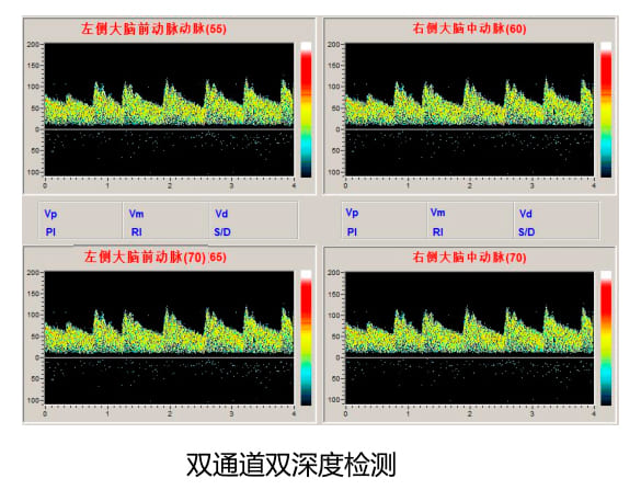 KJ-2V6M多普勒雙通道雙深度檢測圖.jpg