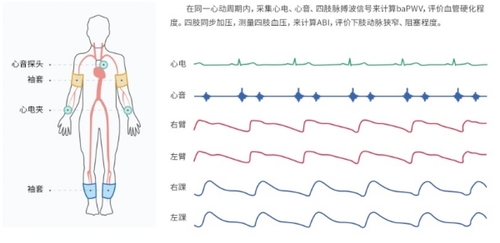 動(dòng)脈硬化檢測儀檢查部位